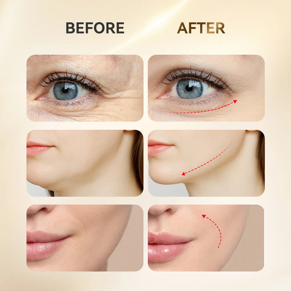 LumiSculpt™ Facial Massager