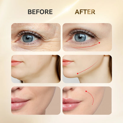 LumiSculpt™ Facial Massager